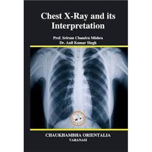 interpretation of chest x-ray an illustrated companion download